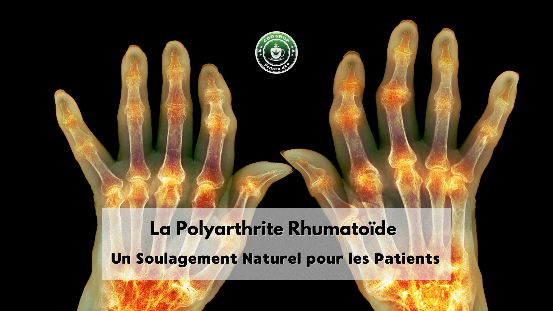 Les Bienfaits du CBD sur la Polyarthrite Rhumatoïde : Un Soulagement Naturel